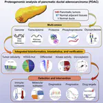 Proteogenomic characterization of pancreatic ductal adenocarcinoma